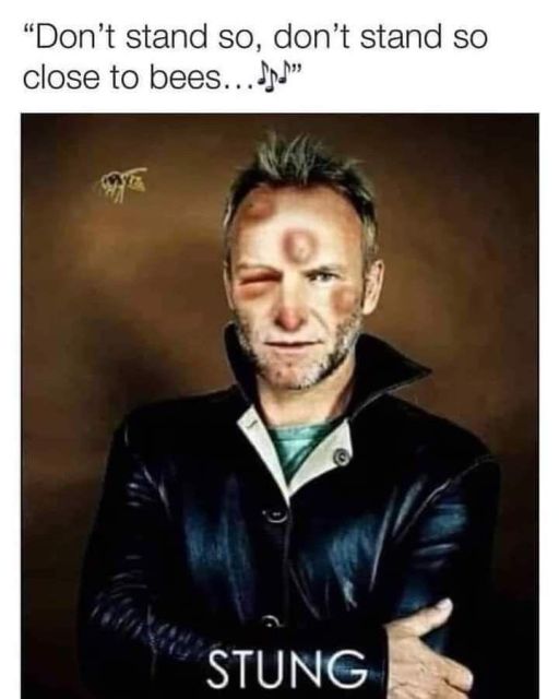 A humorous image featuring Sting with a bruised face, accompanied by a bee and the text, "Don't stand so, don't stand so close to bees." The word "STUNG" is prominently displayed at the bottom.